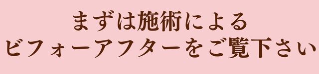 ビフォーアフターをご覧下さい